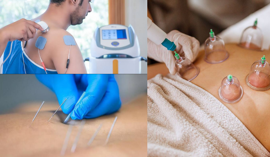 dry-needling